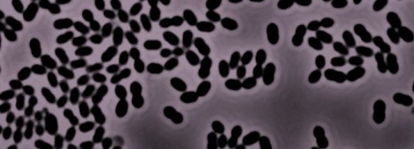 Trying to beat pneumonia; when cell wall building enzymes go rogue